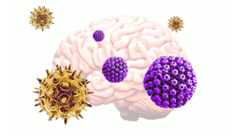  The one-two punch from two common viruses may cause Alzheimer’s disease