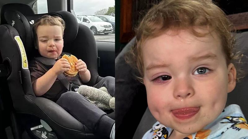 3-Year-Old Boy Left Blind in One Eye