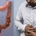  What Causes Constipation? 12 Surprising Reasons You’re Constipated