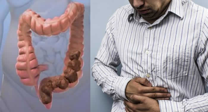 Surprising Reasons You’re Constipated