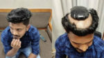 Indian man attempted to smuggle gold Under His Wig