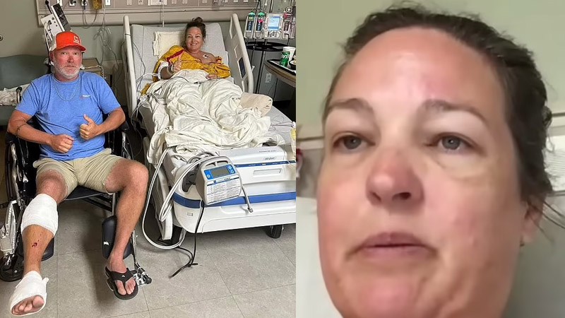  Woman Survives Shark Attack ‘I Thought It Was a Huge Fish and Kicked It’